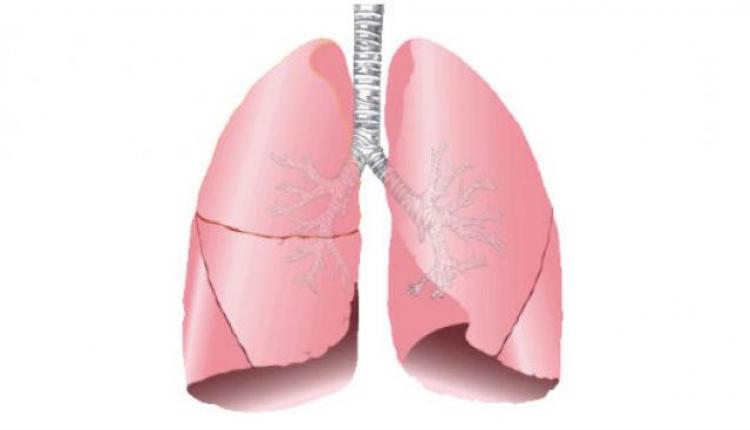 Una fotografía dibujada de los pulmones.